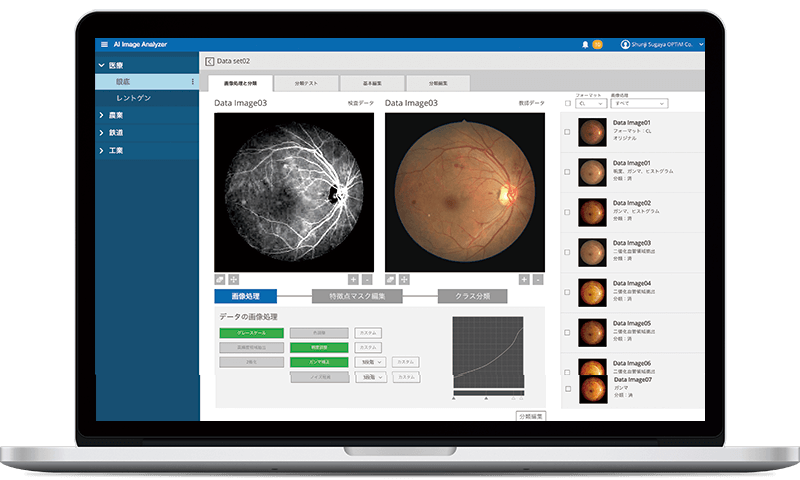 AIを用いた眼底画像解析で課題を解決